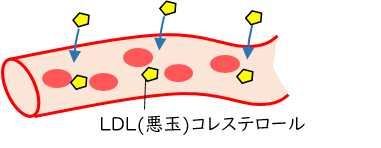 血管と悪玉コレステロールのイラスト