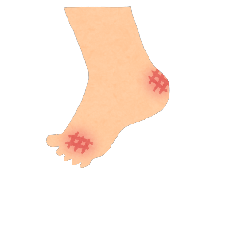 傷ついてしまっている足のイラスト